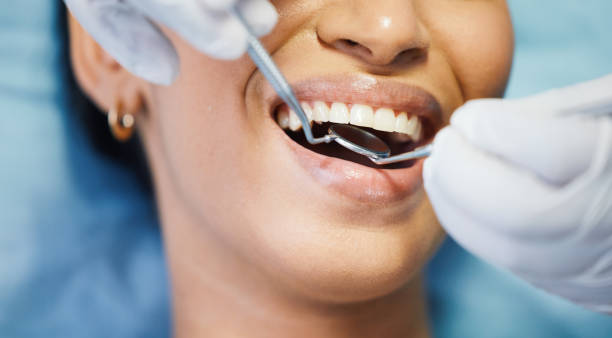 Best Emergency Treatment for Dental Infections or Abscesses in Eatonton, GA